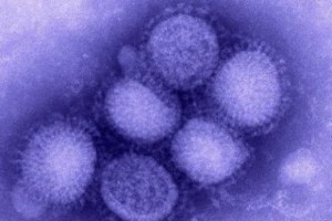 Wirus świńskiej grypy wykryto w pobliżu Płocka