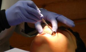 Kolejki do stomatologa w Płocku to średnio… 108 dni. Jest też skromny ‘koszyk’ w ramach leczenia NFZ. Co w nim znajdziemy?